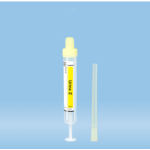 Chloride, Random Urine