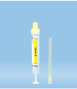 Chloride, Random Urine