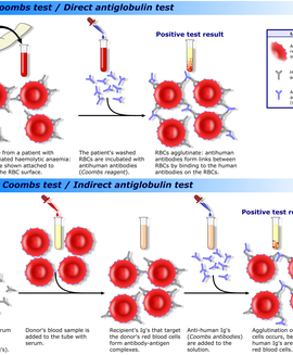 Coomb's Test Direct (Gel Technology)