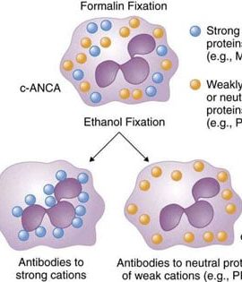 C - ANCA (Anti Neutrophilic Cytoplasmic Antibody)