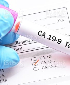 CA19.9 (Pancreatic Cancer)