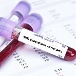 Cardiolipin Antibody IgM