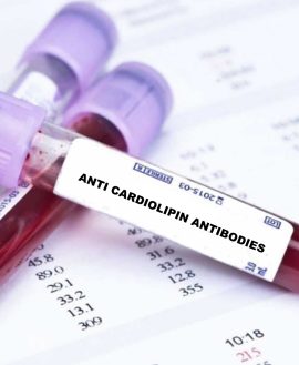 Cardiolipin Antibody IgA