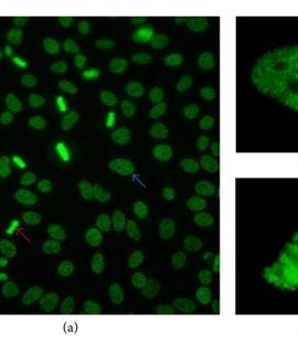 ENA Panel (Comprehensive) -Quantitative -Extractable Nuclear Antigen Comprehensive (Anti SS-A / Ro Antibody Serum,Anti SSB / La Antibody Serum,Jo-1 Antibody,Anti Scl-70 IgG Antibody,U1 snRNP Antibody,Anti Smith Antibody, IgG)