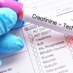 Creatinine, Serum