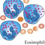 Absolute Eosinophil Count - AEC
