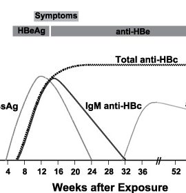 Hbc Igm Ab