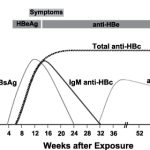 Anti HBcore Total (Hepatitis B Core Antigen Total)