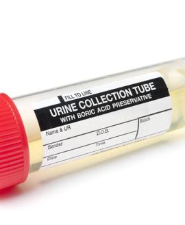 Creatinine, Random Urine