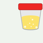 Chloride, 24 Hrs. Urine