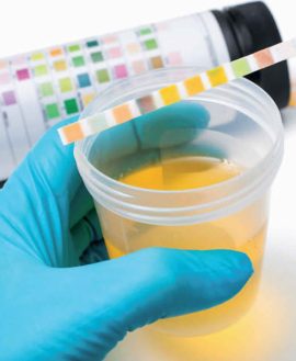Calcium, Random Urine