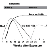 Anti HBe / HBeAb (Hepatitis B Envelope Antibody)