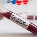 Blood Urea Nitrogen (BUN)
