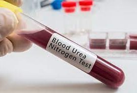 Blood Urea Nitrogen (BUN)