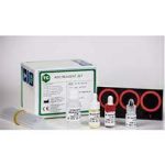 ASLO (Antistrepto Lysin -O)-Quantitative/Titer