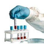 Allergy panel-food, inhalants, contacts