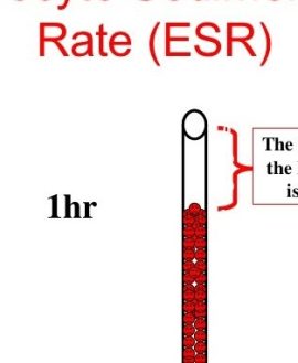 ESR (Westergren's)-Erythrocyte Sedimentation Rate