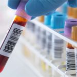 Absolute Lymphocyte Count