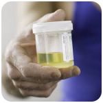 Albumin: Creatine Ratio - A:C Ratio