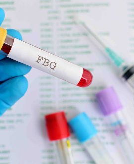 Blood Glucose (Fasting)
