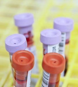 Ear Swab - Culture & Sensitivity Aerobic (Conventional)