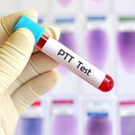 Activated Partial Thromboplastin Time - APTT/ PTTK)