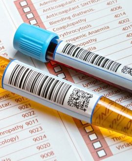 Glucose Tolerance Test (OGTT) , 75 gm glucose -2 samples (fasting and 2 hrs)- Dissolve 82.5 gms Glucose monohydrate(equivalent to 75 g anhydrous glucose) in water
