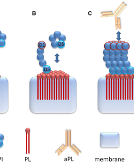 Phospholipid Antibody, IgG