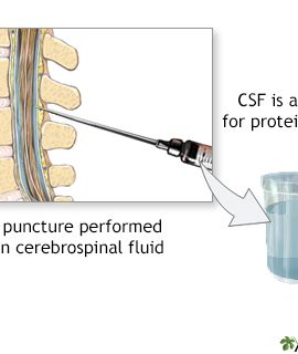 Protein Total, CSF