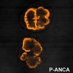 P-ANCA