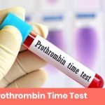 Prothrombin Time (PT) and INR (International Normalized Ratio)