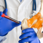 Rheumatoid Factor - RF Factor, Titer