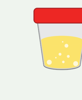 Magnesium, Random Urine