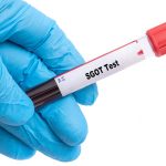 SGOT