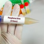 Phosphorus, 24Hrs.Urine