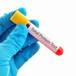 Protein Total, Serum