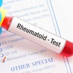 Rheumatoid Factor - RF Factor, Qualitative