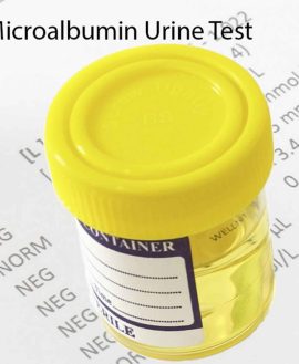 Microalbumin, 24Hrs.Urine