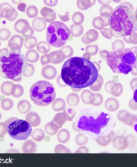 Peripheral Blood Smear