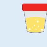 Phosphorus, Random Urine