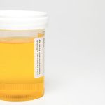Microalbumin Creatinine Ratio, Random Urine